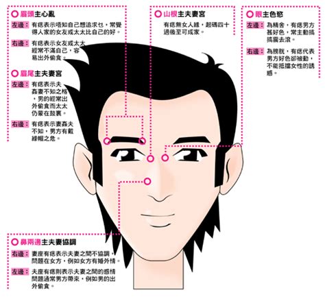 痣 vs 墨|「墨」同「痣」有什麼分別？他們其實是什麼東西？他們又是怎樣。